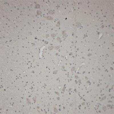 Immunohistochemistry-Paraffin: VAChT/SLC18A3 Antibody [NB100-91348]