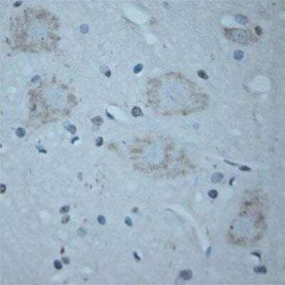 Immunohistochemistry-Paraffin: VAChT/SLC18A3 Antibody [NB100-91348]