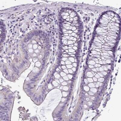 Immunohistochemistry-Paraffin: VAM1 Antibody [NBP1-87365]