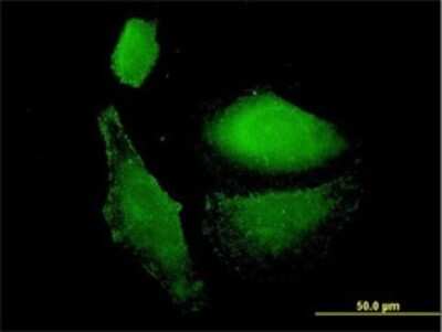 Immunocytochemistry/ Immunofluorescence: VAMP-1 Antibody (5A4) [H00006843-M02]