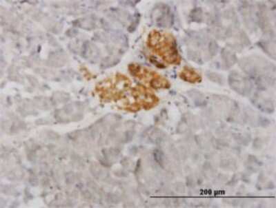 Immunohistochemistry-Paraffin: VAMP-1 Antibody (5A4) [H00006843-M02]
