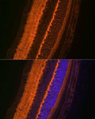 Immunohistochemistry: VAMP-2 Antibody (8X9D9) [NBP3-16362]