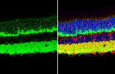 Immunohistochemistry-Paraffin: VAMP-2 Antibody (GT6311) [NBP3-13633]