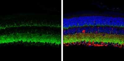 Immunohistochemistry-Paraffin: VAMP-2 Antibody [NBP3-13179]