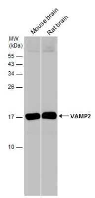 Western Blot: VAMP-2 Antibody [NBP3-13179]