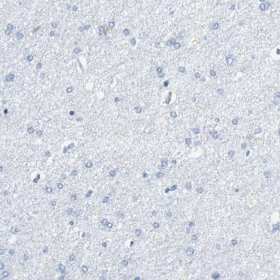 Immunohistochemistry-Paraffin: VAMP-8 Antibody [NBP1-84013]