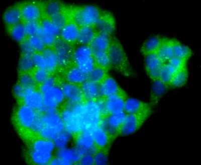 Immunocytochemistry/ Immunofluorescence: VAMP-8 Antibody (JF0963) [NBP2-66777]