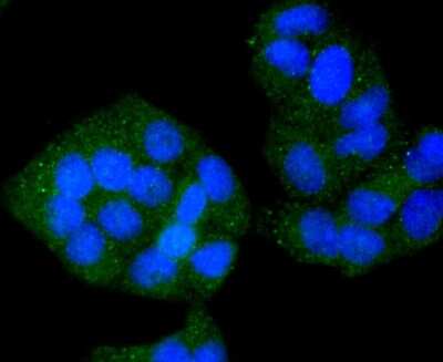 Immunocytochemistry/ Immunofluorescence: VAMP-8 Antibody (JF0963) [NBP2-66777]