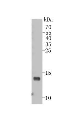 Western Blot: VAMP-8 Antibody (JF0963) [NBP2-66777]