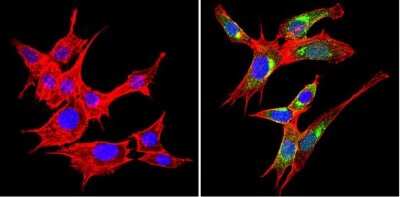 Immunocytochemistry/ Immunofluorescence: VAMP3/Cellubrevin Antibody [NB300-510]