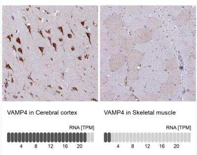 Immunohistochemistry-Paraffin: VAMP4 Antibody [NBP2-13512]