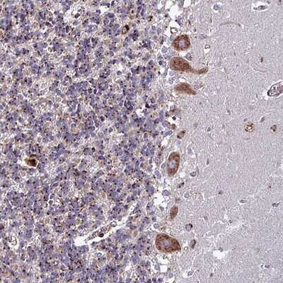 Immunohistochemistry-Paraffin: VAMP4 Antibody [NBP2-13512]