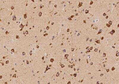 Immunohistochemistry-Paraffin: VAMP4 Antibody [NBP3-05918]