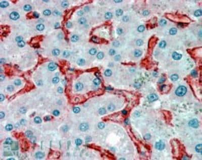 Immunohistochemistry-Paraffin: VAP-1/AOC3 Antibody [NB100-57090]