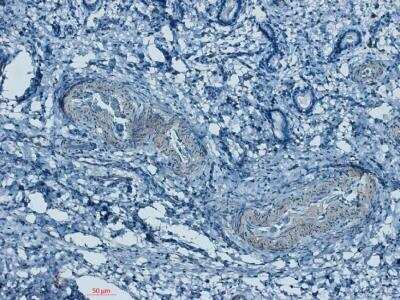 Immunohistochemistry-Paraffin: VAP-1/AOC3 Antibody [NBP1-89671]