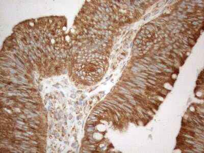 Immunohistochemistry: VAP-A Antibody (OTI10E10) [NBP2-46319]