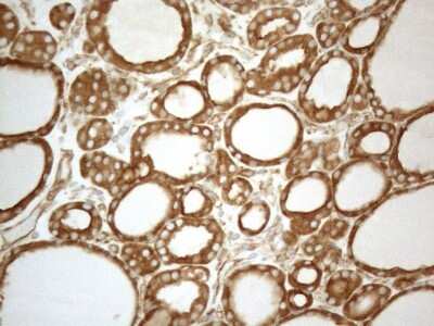 Immunohistochemistry: VAP-A Antibody (OTI10E10) [NBP2-46319]