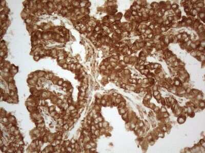 Immunohistochemistry: VAP-A Antibody (OTI10E10) [NBP2-46319]