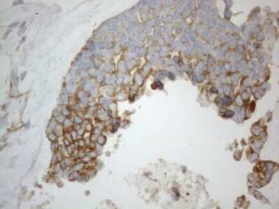 Immunohistochemistry: VAP-A Antibody (OTI10E10) [NBP2-46319]