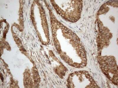 Immunohistochemistry: VAP-A Antibody (OTI10E10) [NBP2-46319]