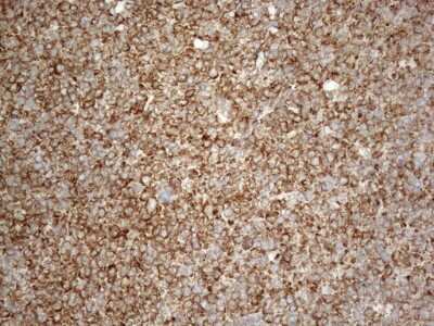 Immunohistochemistry: VAP-A Antibody (OTI10E10) [NBP2-46319]