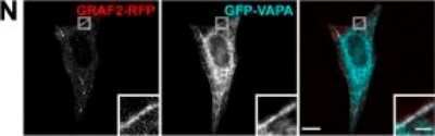 Immunocytochemistry/ Immunofluorescence: VAP-A Antibody [NBP1-31237]