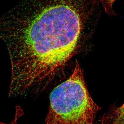 Immunocytochemistry/ Immunofluorescence: VAP-A Antibody [NBP1-83132]