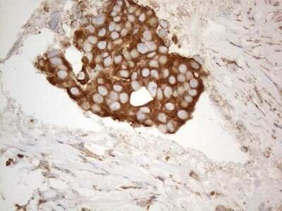 Immunohistochemistry: VAP-A Antibody (OTI10E10) - Azide and BSA Free [NBP2-74825]