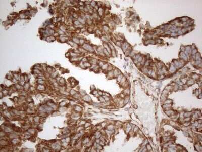 Immunohistochemistry: VAP-A Antibody (OTI10E10) - Azide and BSA Free [NBP2-74825]