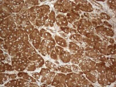 Immunohistochemistry: VAP-A Antibody (OTI10E10) - Azide and BSA Free [NBP2-74825]