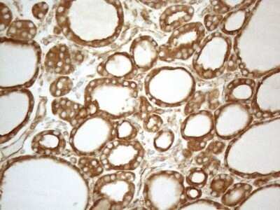 Immunohistochemistry: VAP-A Antibody (OTI10E10) - Azide and BSA Free [NBP2-74825]