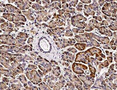 Immunohistochemistry-Paraffin: VAP-B Antibody (103) [NBP2-89625]