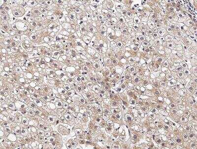 Immunohistochemistry-Paraffin: VAP-B Antibody (103) [NBP2-89625]