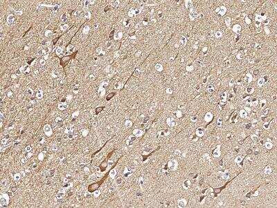 Immunohistochemistry-Paraffin: VAP-B Antibody (103) [NBP2-89625]