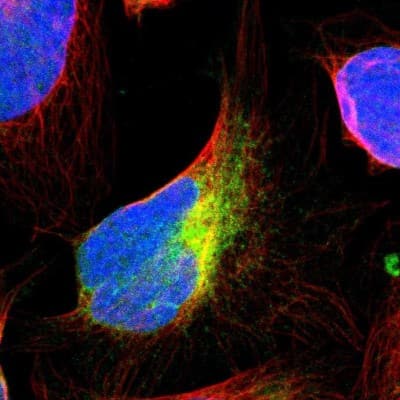 Immunocytochemistry/ Immunofluorescence: VAP-B Antibody [NBP1-89112]