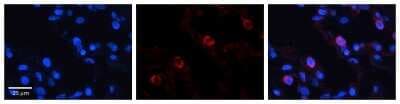 Immunohistochemistry: VARS Antibody [NBP1-55366]