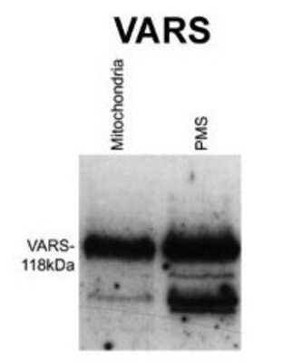 Western Blot: VARS Antibody [NBP1-55366]