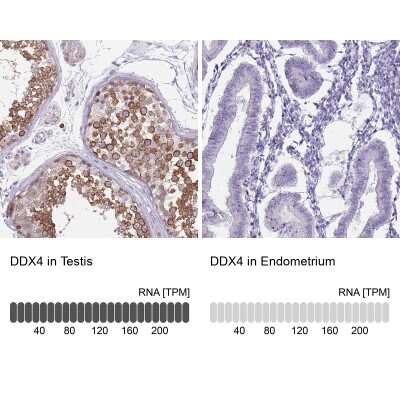 Immunohistochemistry-Paraffin: VASA Antibody [NBP2-13907]