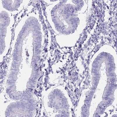 Immunohistochemistry-Paraffin: VASA Antibody [NBP2-13908]