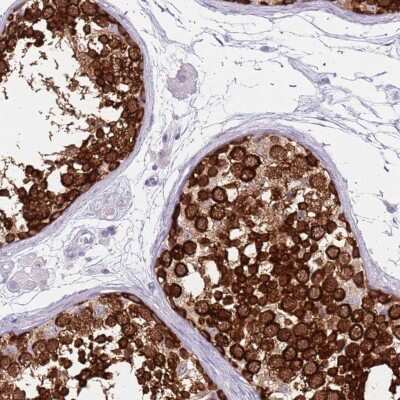 Immunohistochemistry-Paraffin: VASA Antibody [NBP2-13908]