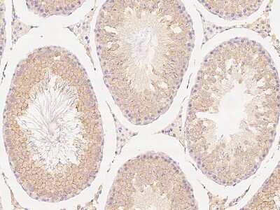 Immunohistochemistry-Paraffin: VASA Antibody [NBP2-95280]