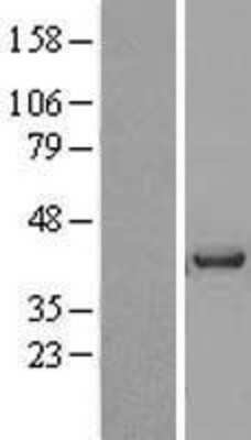 Western Blot: Vasohibin Overexpression Lysate [NBL1-17697]