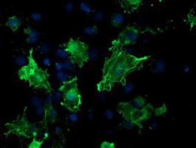 Immunocytochemistry/ Immunofluorescence: VASP Antibody (OTI4D6) [NBP2-00555]