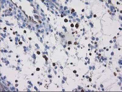 Immunohistochemistry-Paraffin: VASP Antibody (OTI4D6) [NBP2-00555]