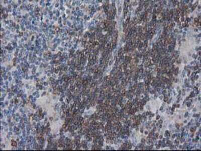Immunohistochemistry-Paraffin: VASP Antibody (OTI4D6) [NBP2-00555]
