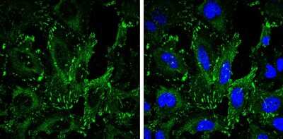 Immunocytochemistry/ Immunofluorescence: VASP Antibody (GT238) [NBP3-13619]