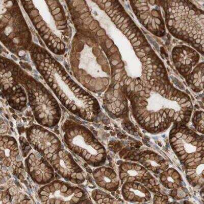 Immunohistochemistry-Paraffin: VASP Antibody [NBP1-85792]