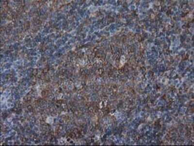 Immunohistochemistry: VASP Antibody (OTI4D6) - Azide and BSA Free [NBP2-74830]