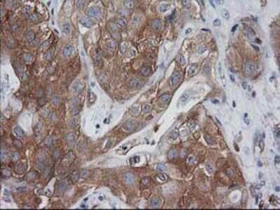 Immunohistochemistry: VASP Antibody (OTI4D6) - Azide and BSA Free [NBP2-74830]