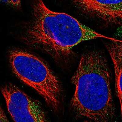 Immunocytochemistry/ Immunofluorescence: VAT1L Antibody [NBP1-92570]